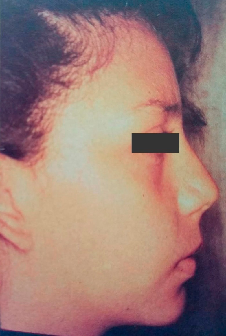 Caso 1 después — rostro armónico