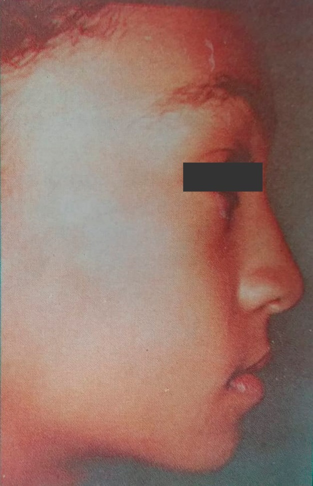 Caso 2 después — rostro armónico